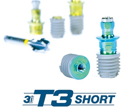 ショートインプラント